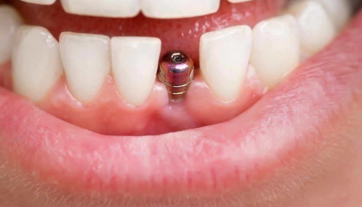 Fun Dental Facts… Did You Know?