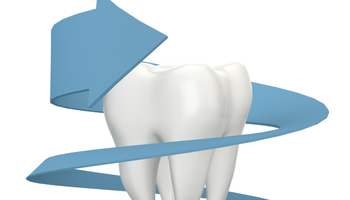 The Necessity of Dental Crowns
