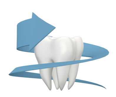 The Necessity of Dental Crowns